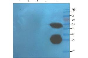 Western Blot using anti-TNF alpha antibody  Mouse liver (lane 1), mouse spinal cord (lane 2), mouse testis (lane 3), mouse colon (lane 4) and human thyroid tumour (lane 5) samples were resolved on a 10% SDS PAGE gel and blots probed with  at 1. (Rekombinanter TNF alpha (Infliximab Biosimilar) Antikörper)