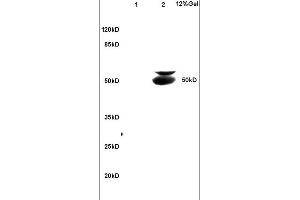 Lane 1: mouse brain lysates Lane 2: mouse intestine lysates probed with Anti BECN1/Beclin 1/ATG6 Polyclonal Antibody, Unconjugated (ABIN675384) at 1:200 in 4C. (Beclin 1 Antikörper  (AA 201-330))