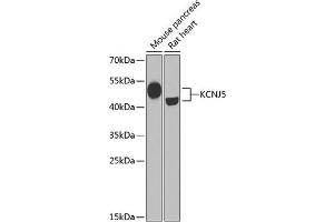 Western blot analysis of extracts of various cell lines, using KCNJ5 Antibody (ABIN6134098, ABIN6142740, ABIN6142741 and ABIN6221828) at 1:1000 dilution. (KCNJ5 Antikörper  (AA 50-150))