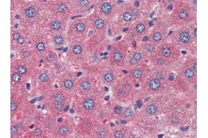 Mouse Liver (formalin-fixed, paraffin-embedded) stained with TSLPfollowed by biotinylated goat anti-rabbit IgG secondary antibody, alkaline phosphatase-streptavidin and chromogen. (Thymic Stromal Lymphopoietin Antikörper)