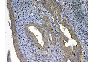IHC analysis of UGT1A1 using anti-UGT1A1 antibody . (UGT1A1 Antikörper  (AA 316-533))