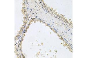 Immunohistochemistry of paraffin-embedded human prostate using POMGNT1 antibody. (POMGNT1 Antikörper  (AA 411-660))