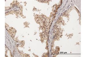 Immunostaining (ISt) image for anti-Poliovirus Receptor-Related 2 (Herpesvirus Entry Mediator B) (PVRL2) (AA 1-479) antibody (ABIN519552)