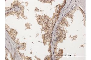 Immunoperoxidase of purified MaxPab antibody to PVRL2 on formalin-fixed paraffin-embedded human prostate. (PVRL2 Antikörper  (AA 1-479))