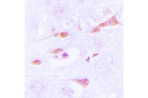 Immunohistochemical analysis of CaMK2 alpha/delta staining in human brain formalin fixed paraffin embedded tissue section. (CaMK2 alpha/delta Antikörper  (Center))