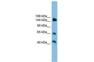 Image no. 1 for anti-Jumonji, AT Rich Interactive Domain 2 (JARID2) (AA 201-250) antibody (ABIN6744599) (JARID2 Antikörper  (AA 201-250))