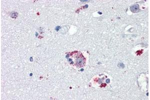 Anti-TAAR8 / TA5 antibody IHC staining of human brain, amygdala. (Trace Amine Associated Receptor 8 (TAAR8) (N-Term) Antikörper)