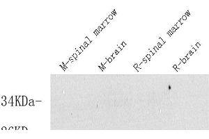 Western Blot analysis of various samples using VIP Polyclonal Antibody at dilution of 1:600. (Vip Antikörper)