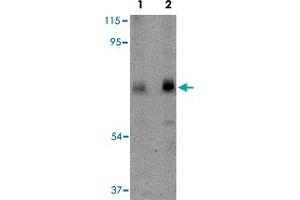 Western blot analysis of CAPN6 in rat lung tissue lysate with CAPN6 polyclonal antibody  at (Lane 1) 0. (Calpain 6 Antikörper  (C-Term))