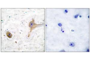 Immunohistochemical analysis of paraffin-embedded human brain tissue using GABA B Receptor antibody. (GABA B Receptor (C-Term) Antikörper)