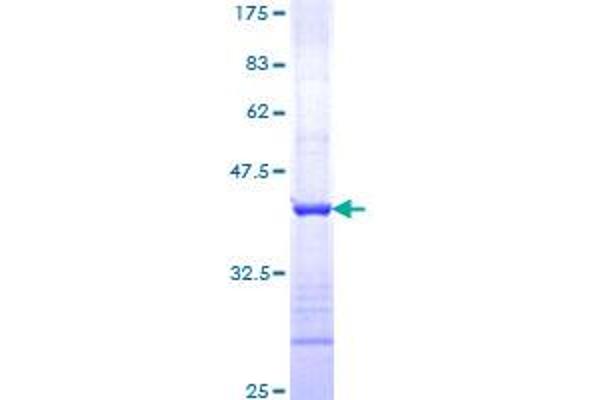 ST14 Protein (AA 298-400) (GST tag)