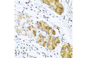 Immunohistochemistry of paraffin-embedded human stomach using CCL8 antibody (ABIN5975074) at dilution of 1/100 (40x lens). (CCL8 Antikörper)
