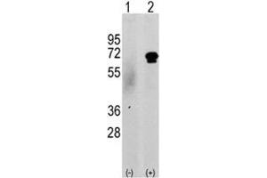Western blot analysis of CAMKK2 antibody and 293 cell lysate either nontransfected (c) or transiently transfected with the CAMKK2 gene (2). (CAMKK2 Antikörper  (AA 52-82))