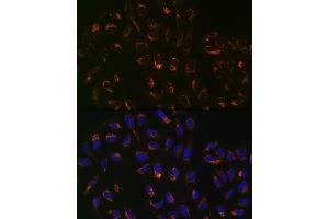 Immunofluorescence analysis of U-2 OS cells using PBR/TSPORabbit mAb (ABIN1679051, ABIN3019258, ABIN3019259 and ABIN7101738) at dilution of 1:100 (40x lens). (TSPO Antikörper)