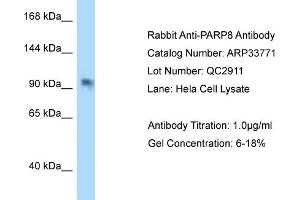 WB Suggested Anti-PAntibody   Titration: 1. (PARP8 Antikörper  (C-Term))