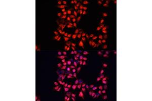 Immunofluorescence analysis of HeLa cells using  antibody (ABIN6129173, ABIN6136519, ABIN6136520 and ABIN6214691) at dilution of 1:100.