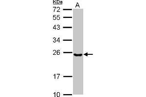 WB Image Sample (30 ug of whole cell lysate) A: NT2D1 12% SDS PAGE antibody diluted at 1:1000 (Ube2t Antikörper  (C-Term))