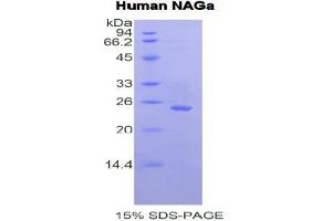SDS-PAGE analysis of Human NAGa Protein. (NAGA Protein)