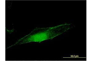 Immunofluorescence of monoclonal antibody to MGEA5 on HeLa cell. (MGEA5 Antikörper  (AA 823-916))