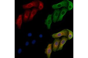 ABIN6264324 and ABIN6272396 staining Hela cells by IF/ICC. (PNPT1 Antikörper  (C-Term))