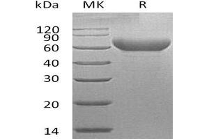 Western Blotting (WB) image for Hepatitis A Virus Cellular Receptor 2 (TIM 3) protein (Fc Tag) (ABIN7320954)