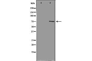Western blot analysis of Hela whole cell lysates, using NEK8 Antibody. (NEK8 Antikörper  (Internal Region))