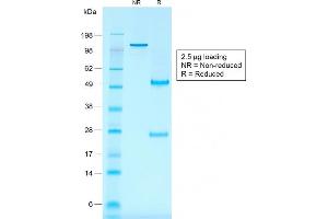 SDS-PAGE Analysis Purified CD30 Mouse Recombinant Monoclonal Antibody (rKi-1/779). (Rekombinanter TNFRSF8 Antikörper)
