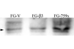 FG Pancreatic Carcinoma Cell Lines stably expressing vector along (FG-V) the b3 integrin subunit (FG-b3) or a b3 truncation mutant (FG-759x). (Src Antikörper  (pTyr215))