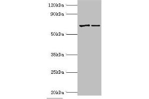 Western blot All lanes: Myotubularin antibody at 2 μg/mL Lane 1: Jurkat whole cell lysate Lane 2: HepG2 whole cell lysate Secondary Goat polyclonal to rabbit IgG at 1/10000 dilution Predicted band size: 70, 67 kDa Observed band size: 70 kDa (MTM1 Antikörper  (AA 484-603))