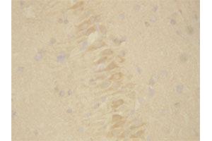 Immunohistochemistry (Formalin/PFA-fixed paraffin-embedded sections) of rat brain tissue with PSEN2 polyclonal antibody . (Presenilin 2 Antikörper  (Internal Region))