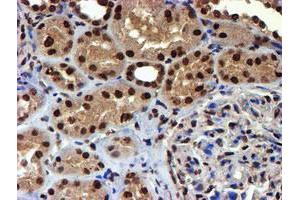 Immunohistochemical staining of paraffin-embedded Human Kidney tissue using anti-TOMM34 mouse monoclonal antibody. (TOMM34 Antikörper)