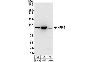 anti-Plasmodium falciparum Histidine Rich Protein 2 (Pf HRP2) (AA 621-671) antibody