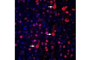 Expression of GPR17 in rat parietal cortex - Immunohistochemical staining of perfusion-fixed frozen rat brain sections with Anti-GPR17 Antibody (ABIN7043149, ABIN7044435 and ABIN7044436), (1:300), followed by donkey-anti-rabbit-biotin and streptavidin-Cy3. (GPR17 Antikörper  (Intracellular))