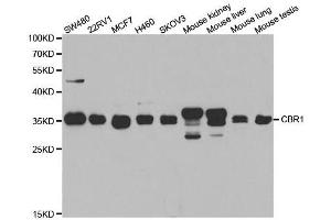 Western blot analysis of extracts of various cell lines, using CBR1 antibody. (CBR1 Antikörper  (AA 1-277))