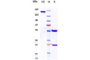 Anti-FGF23 Reference Antibody (burosumab) on SDS-PAGE under reducing (R) condition.