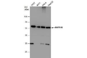 WB Image BMPR1B antibody detects BMPR1B protein by western blot analysis. (BMPR1B Antikörper)