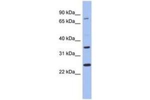Image no. 1 for anti-Zinc Finger Protein 133 (ZNF133) (N-Term) antibody (ABIN6742760) (ZNF133 Antikörper  (N-Term))