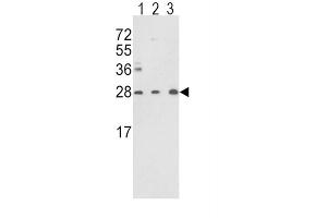 Western Blotting (WB) image for anti-Triosephosphate Isomerase 1 (TPI1) antibody (ABIN3001712) (TPI1 Antikörper)