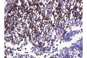 Image no. 1 for anti-Sialophorin (SPN) antibody (ABIN1497318) (CD43 Antikörper)