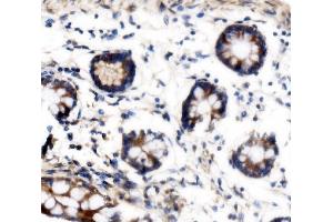 IHC analysis of VPRBP/DCAF1 using anti-VPRBP/DCAF1 antibody (ABIN7602005). (DDB1 and CUL4-Associated Factor 1 (DCAF1) (AA 540-861) Antikörper)