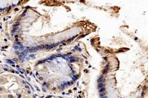 Immunohistochemistry (Paraffin-embedded Sections) (IHC (p)) image for anti-Synaptotagmin Like Protein 2 (SYTL2) antibody (ABIN7075797)
