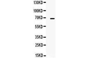 Western Blotting (WB) image for anti-Matrix Metallopeptidase 9 (Gelatinase B, 92kDa Gelatinase, 92kDa Type IV Collagenase) (MMP9) (AA 633-667), (C-Term) antibody (ABIN3043582) (MMP 9 Antikörper  (C-Term))