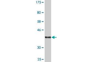 Western Blot detection against Immunogen (36. (RABEP1 Antikörper  (AA 765-862))