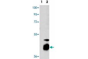 Western blot analysis of DUSP7 (arrow) using DUSP7 polyclonal antibody . (DUSP7 Antikörper  (N-Term))