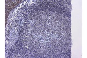 IHC analysis of NRF1 using anti-NRF1 antibody (ABIN6719347). (NRF1 Antikörper  (AA 246-503))