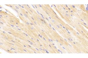 Detection of TIMP2 in Mouse Cardiac Muscle Tissue using Polyclonal Antibody to Tissue Inhibitors Of Metalloproteinase 2 (TIMP2)
