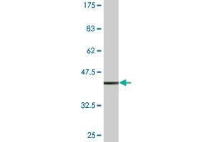 Western Blot detection against Immunogen (35. (T-Box 22 Antikörper  (AA 431-519))