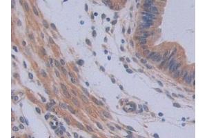 DAB staining on IHC-P; Samples: Mouse Uterus Tissue (IL12A Antikörper  (AA 23-215))