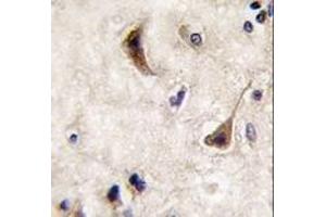 Image no. 2 for anti-Protein tyrosine Phosphatase, Non-Receptor Type 5 (Striatum-Enriched) (PTPN5) (N-Term) antibody (ABIN360755)