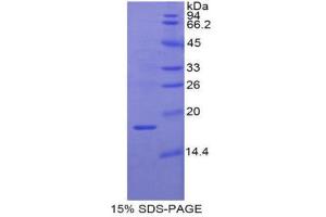 SDS-PAGE (SDS) image for Retinol Binding Protein 2, Cellular (RBP2) (AA 1-134) protein (His tag) (ABIN1879330) (RBP2 Protein (AA 1-134) (His tag))
